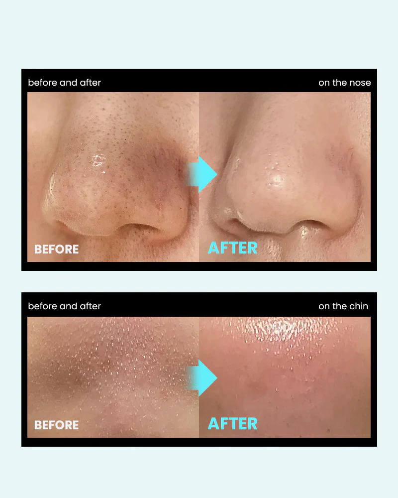 ilso Super Melting Sebum Softener - Image 4