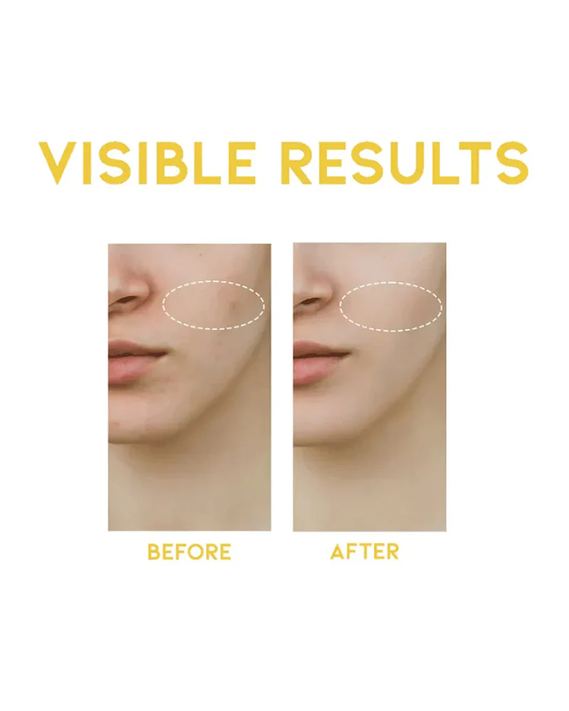 #OOTD Dark Spot Vitamin C Serum - Image 5