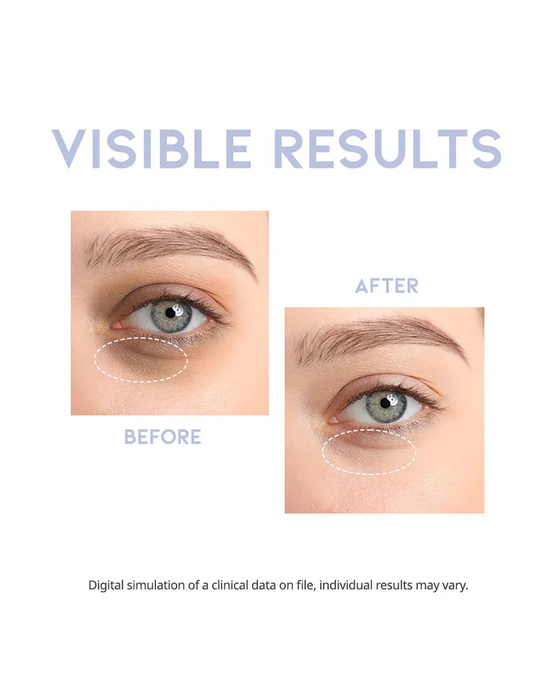 #OOTD Intensive Eye Serum - Image 5