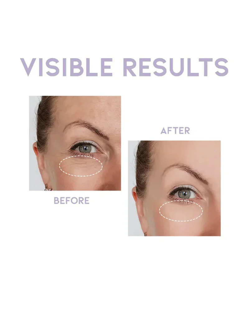 #OOTD Overnight Eye Cream - Image 5